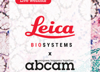 【Abcam x Leica】聯合線上講座 - Expert Insights on IHC and Multiplexing Techniques with BOND RX Optimization - 【Abcam x Leica】聯合線上講座 - Expert Insights on IHC and Multiplexing Techniques with BOND RX Optimization