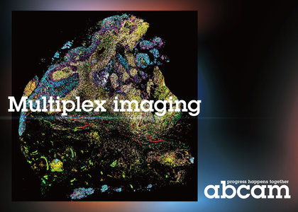 Abcam - 多重組織染色 Multiplex Imaging - Abcam - 多重組織染色 Multiplex Imaging