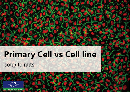 初代細胞和細胞株的差異 - 初代細胞和細胞株的差異